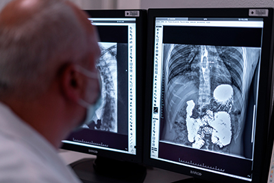 2025R fundaCx covidpersistente